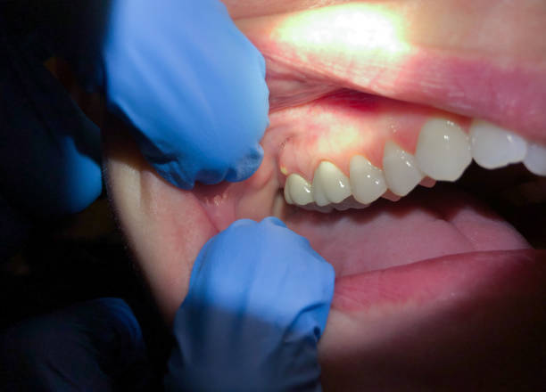 Trusted TX Emergency Dental Service Experts