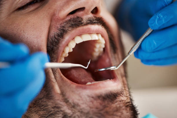 Best Weekend Emergency Dental Services in Muenster, TX